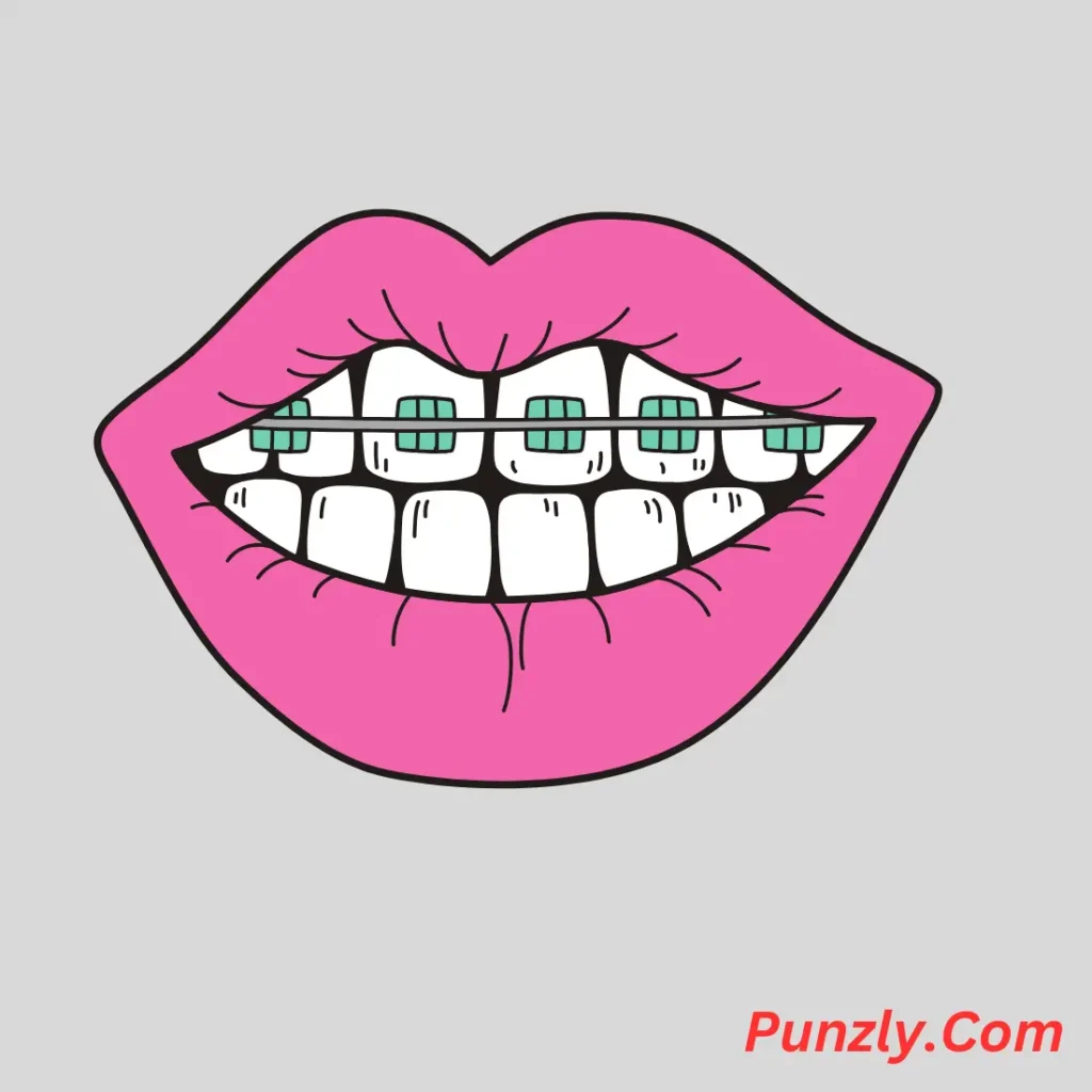 Braces Puns Captions