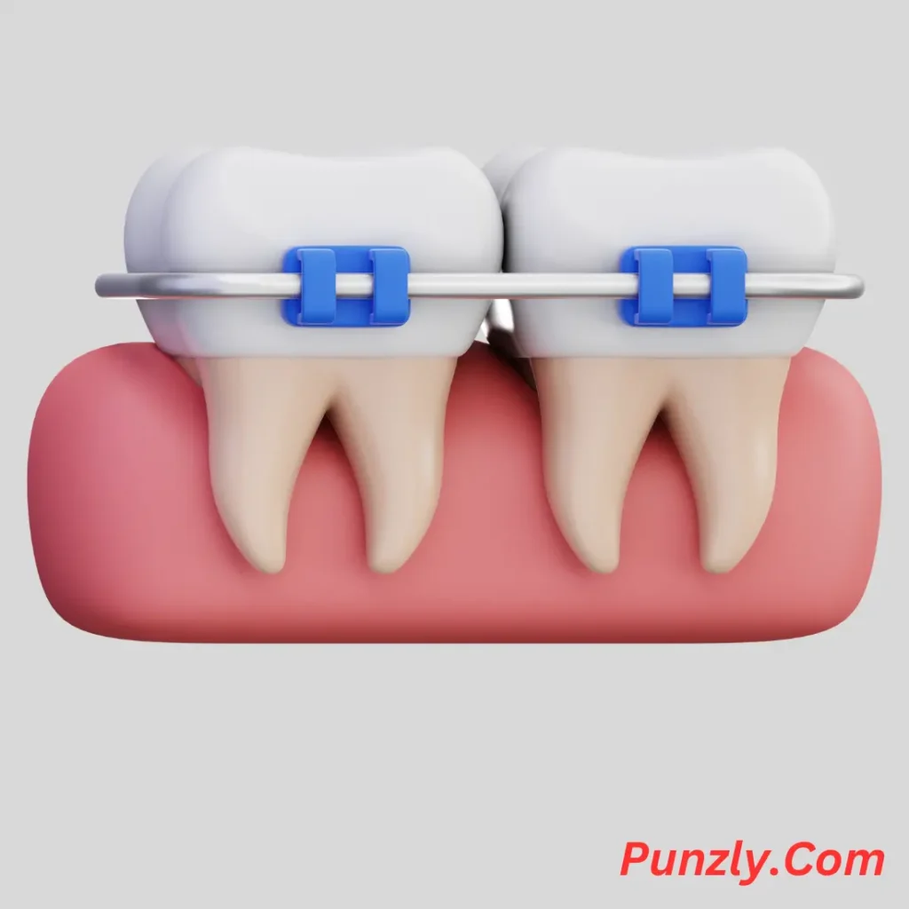 Funny Braces